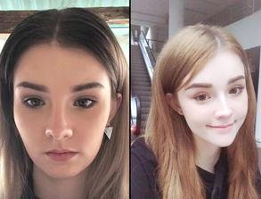 网红整容过程,揭秘整容全过程